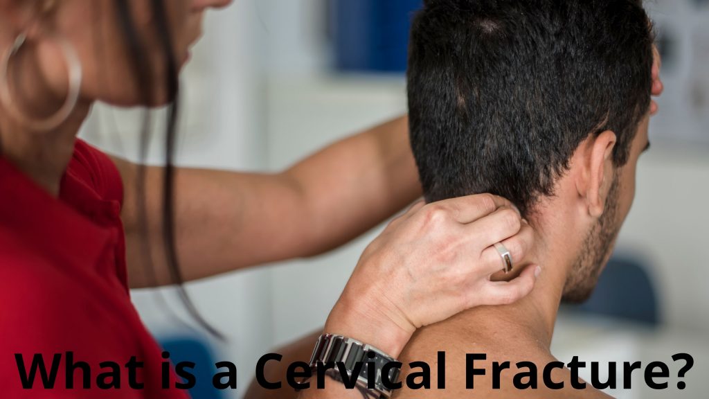 What is a Cervical Fracture