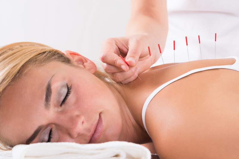 The Benefits of Acupuncture Treatment for Chronic Pain Management